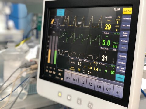The medical ventilator monitoring screen in operating room.