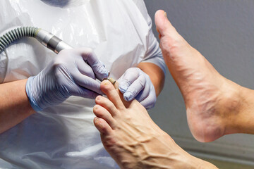 Medizinische Fußpflege-Behandlung beim Mann