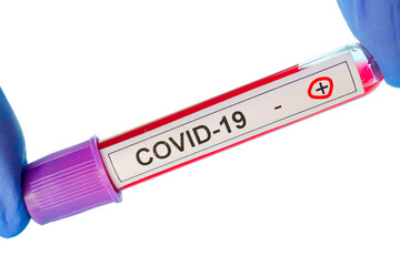 Test tube with positive test for coronavirus isolated on white background. Test tube with covid-19...
