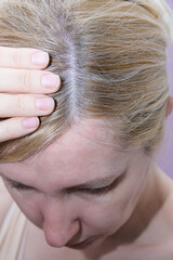 A blond woman inspecting her hair, hair loss, alopecia and hair treatment concept