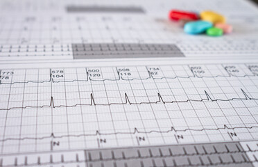 Colored pills on an electrocardiogram paper. Medications for cardiac patients. Heartbeats recorded on paper. Selective focus.