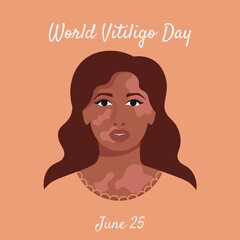 Woman portrait with vitiligo. Concept to support people with Vitiligo skin disorder. Skin problem. Vector isolated illustration