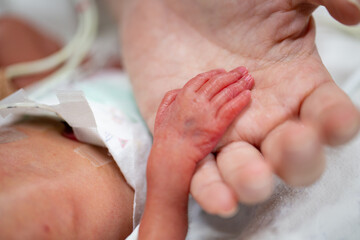 Newborn neonatal infant pulse oximeter premature - obrazy, fototapety, plakaty