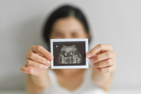 Happy Young Pregnant woman holding showing ultrasound scan photo.