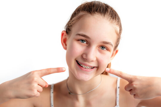 Close up of a teenage girl smiling in orthodontic brackets banner. Girl with braces on teeth.
