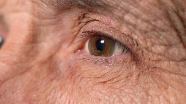 Close-up of an Elderly Man's Left Eye. Tightly Shutting his Eyes and Opening his Eyes. Constriction of the Eye Pupil from light.