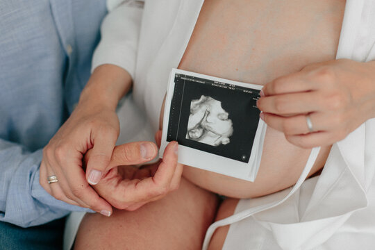 Young couple holding a snapshot of the future ultrasound of the child. Pregnancy concept. Pregnant girl. Hands of young parents.