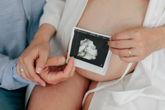 Young couple holding a snapshot of the future ultrasound of the child. Pregnancy concept. Pregnant girl. Hands of young parents.