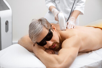 Closeup Hair removal cosmetology procedure from men back laser epilation studio