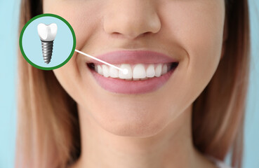 Young woman with implanted teeth, closeup