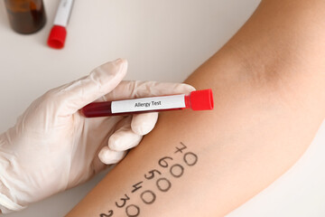 Young woman undergoing procedure of allergen skin tests in clinic