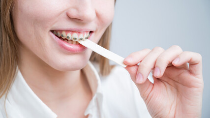 Young woman with metal braces on her teeth is chewing gum. The girl is eating gummy candy