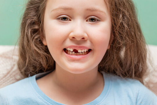 The little girl has no tooth. The child lost a baby tooth. High quality photos