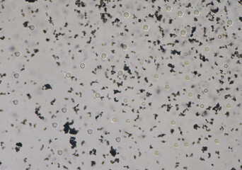Cryptococcus neoformans is an encapsulated yeast India ink preparetion.