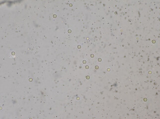 Cryptococcus neoformans is an encapsulated yeast India ink preparetion.