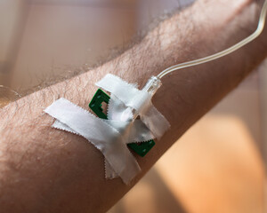 Detail of arm with drip attached