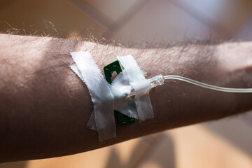 Detail of arm with drip attached