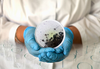 a girl in a medical gown and gloves holds a photo aspergillus niger from a microscope in a round frame