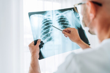 Male doctor examining the patient chest x-ray film lungs scan at radiology department in hospital.Covid-19 scan body xray test detection for covid worldwide virus epidemic spread concept. - obrazy, fototapety, plakaty