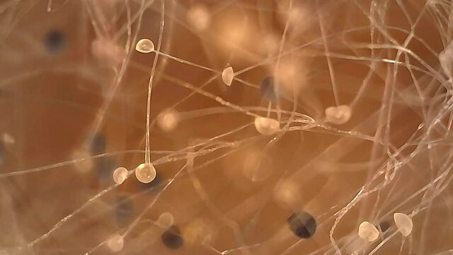 Microscope Mold Sporangium and Sporangiospore 1000x White Biology Fungi