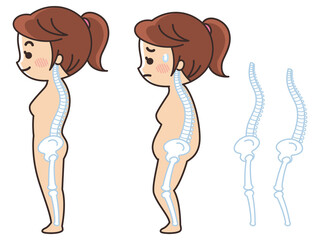 良い姿勢と悪い姿勢　猫背　背骨