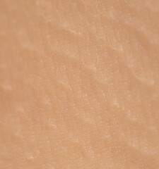 Close up of human skin as background.