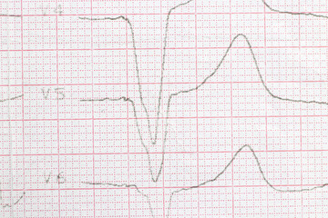 Naklejka premium Macro photo of ECG cardiogram of a patient with a heart attack.