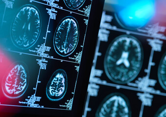 Brain scans of possible disease or damage in clinic