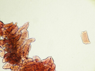 豚筋肉3（100倍）の顕微鏡写真