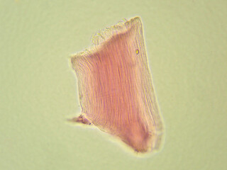豚筋肉6（400倍）の顕微鏡写真
