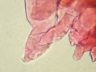 豚筋肉7（400倍）の顕微鏡写真