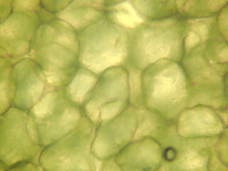 豚脂肪（1000倍）の顕微鏡写真