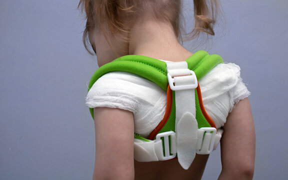 Little girl child with broken collarbone or with poor posture in orthopedic corset reclinator ring Delbe on gray blue background. Treatment of spine and collarbone injuries at Toddler and kid.