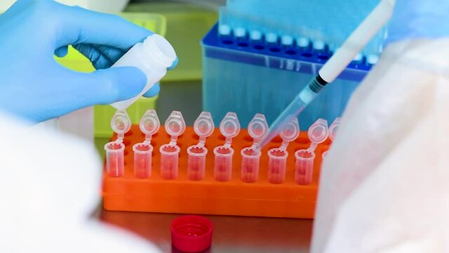 close-up of the hands of a PCR lab worker in rubber gloves with a dispenser pouring samples of liquid with a virus or vaccine. The concept of coronavirus, covid-19