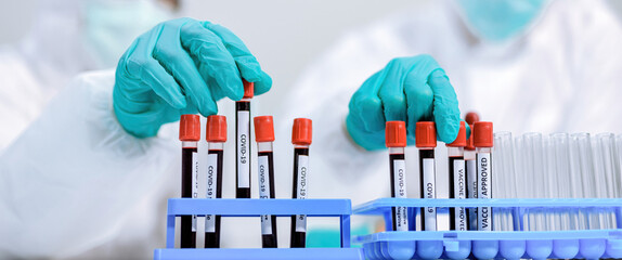 Scientists are selecting blood results for viral tests - 19 that are beneficial for humans..