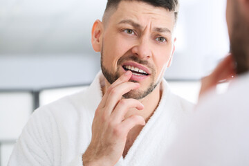 Man suffering from tooth ache in morning