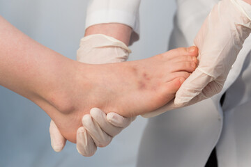 The doctor gently feels the child's foot. Bruises are visible on the patient's leg. Appointment with a doctor. Surgeon, traumatologist or orthopedist. Palpation. Bruise or fracture