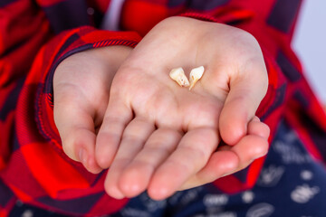 close-up milk teeth removed