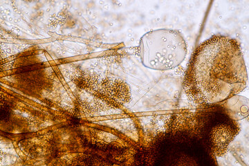 Characteristics of Rhizopus is a genus of common saprophytic fungi on Slide under the microscope for education.
