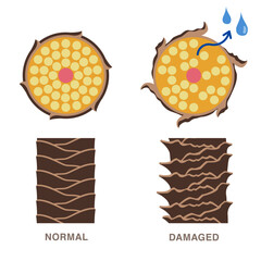 Normal and damaged hair. Damaged hair loses moisture. Smooth and damaged cuticle. vector illustration. 
