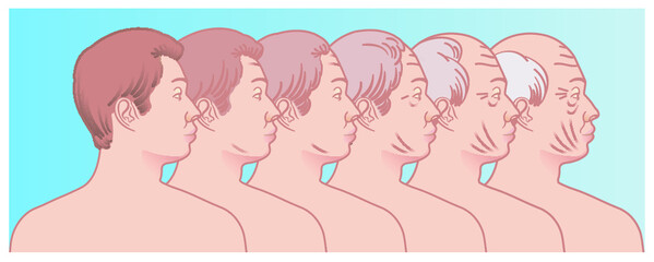 Simple illustration shows the progressive aging of the face of a man.