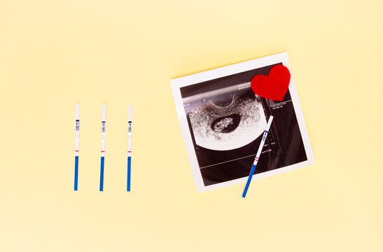 Negative and positive pregnancy test strips, ultrasound picture of the fetus, red hearts. The concept of conception, waiting for the birth of a child, a family.
