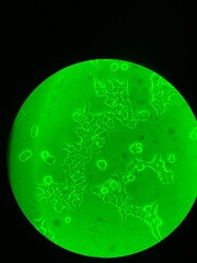 Human cells under the microscope 