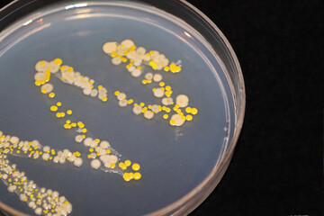 An agar dish with bacteria and fungi colonies against black