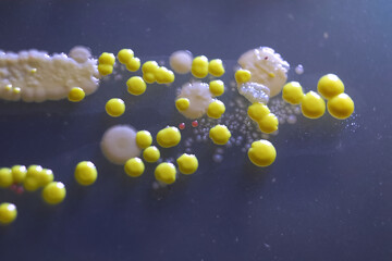 Macro view of bacteria and baker yeast colonies