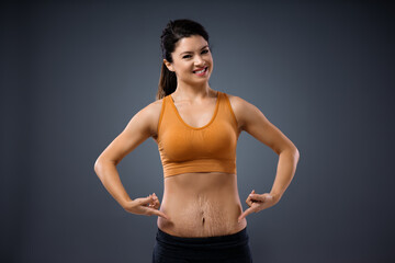 Young mum standing and pointing at her belly full of stretch marks after pregnancy.