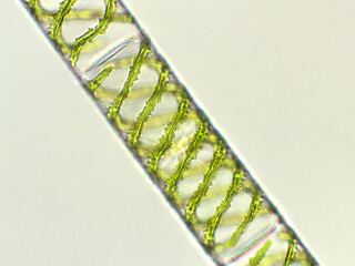 Spirogyra sp. algae under microscopic view