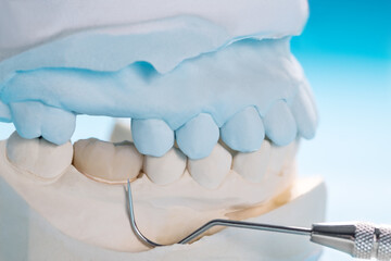 Fototapeta na wymiar Closeup / Prosthodontics or Prosthetic / Single teeth crown and bridge equipment model express fix restoration.
