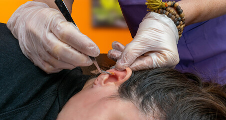 terapeuta de auriculoterapia poniendo agujas , semillas y chinchetas en la oreja de una paciente durante una sesión de auriculoterapia - obrazy, fototapety, plakaty