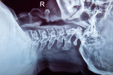 spine of a human body on x-ray